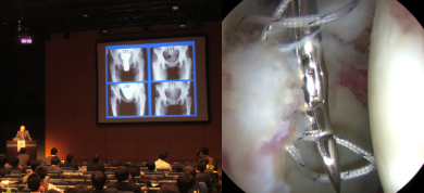 日本股関節鏡研究会
